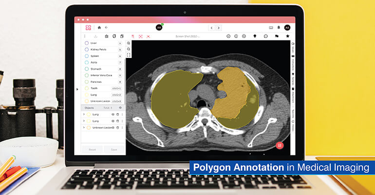 Polygon annotation in Medical Imaging